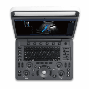 Sonoscape E2 Ultrasound System